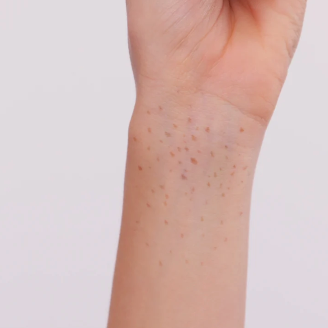Freckle Pen
